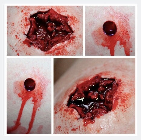 Entry & Exit Bullet Gunshot Wound Prosthetic Silicone Bundle for Film, TV, Halloween, Special Effects Makeup (SFX), Zombie, Film, ForensicFX