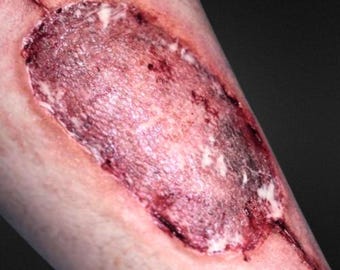 Infected Skin Graft Silicone Prosthetic – Burn & Pus SFX Medical Makeup