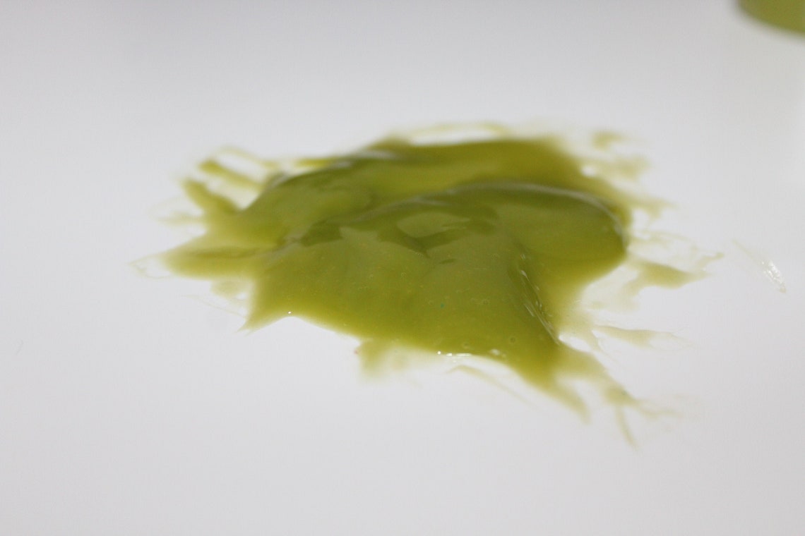 0 Result Images of Dark Green Lumps Of Phlegm PNG Image Collection