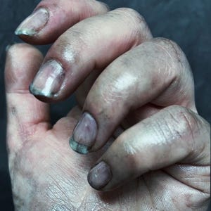 May include: Close-up of a hand with dirty skin and nails. The nails are short and have a dark, greenish-grey colour at the tips. The skin appears aged and has visible lines and imperfections. The hand is slightly open, with the fingers curled.