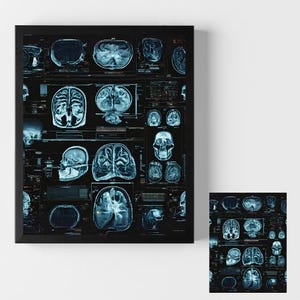Peut inclure: Impression encadrée présentant un collage d'images médicales, notamment des coupes transversales du cerveau et des images de crânes. Les scans sont rendus dans des tons de bleu et de blanc sur fond noir, créant une esthétique scientifique.