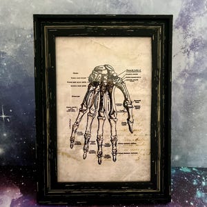 Greys Anatomy Esqueleto Mão Quadro Detalhado Diagrama Médico. Autópsia, cirurgia cartões educacionais, desenho, arte, horror prop, boticário