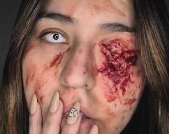 Silicone Prosthetic - Eye Injury Wound