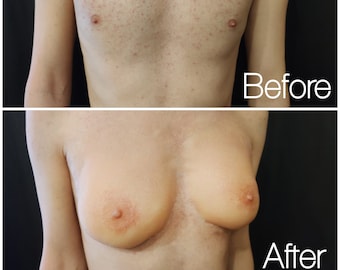 Silikon Prothetische Brüste und Nippel (B Cup) | Fake Boobs | Latexfrei | Für Drag Queens, Transgender, Crossdresser, Cosplayer, LARPer, ...