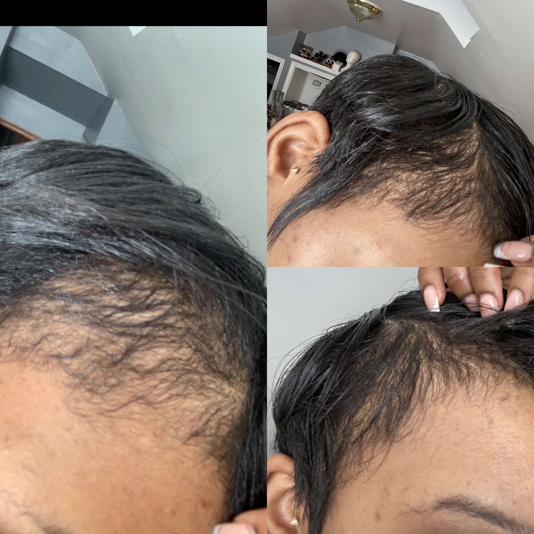 Postpartum Shedding and Dryness Natural Hair Oil for Hair Loss - Etsy Postpartum Shedding and Dryness Natural Hair Oil for Hair Loss - Etsy