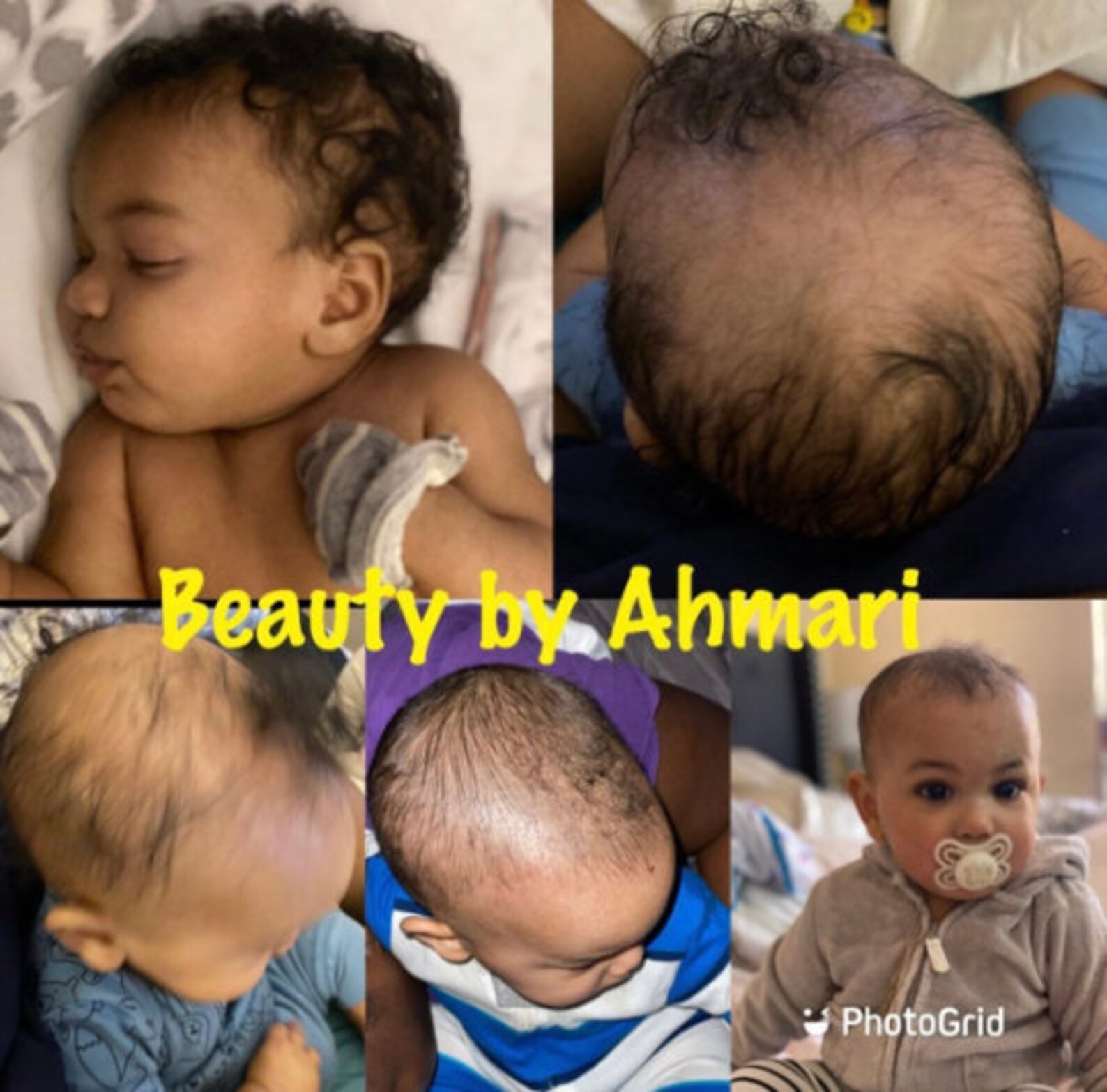 Baby Hair Care Bundle for Cradle Cap Hair Loss Growth and Etsy