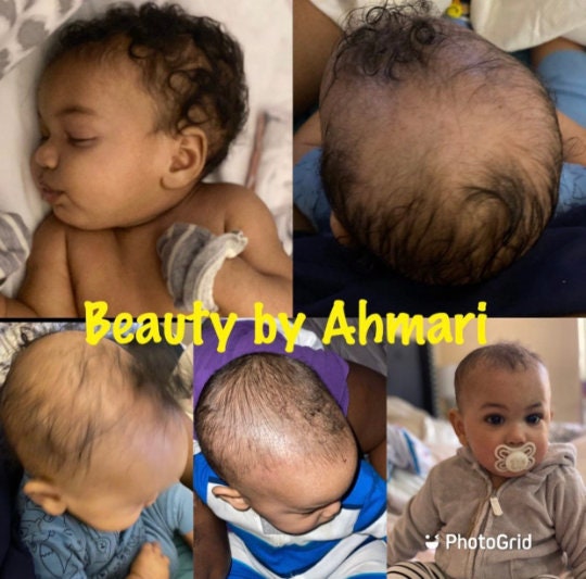 Baby Hair Care Bundle for Cradle Cap Hair Loss Growth and Etsy