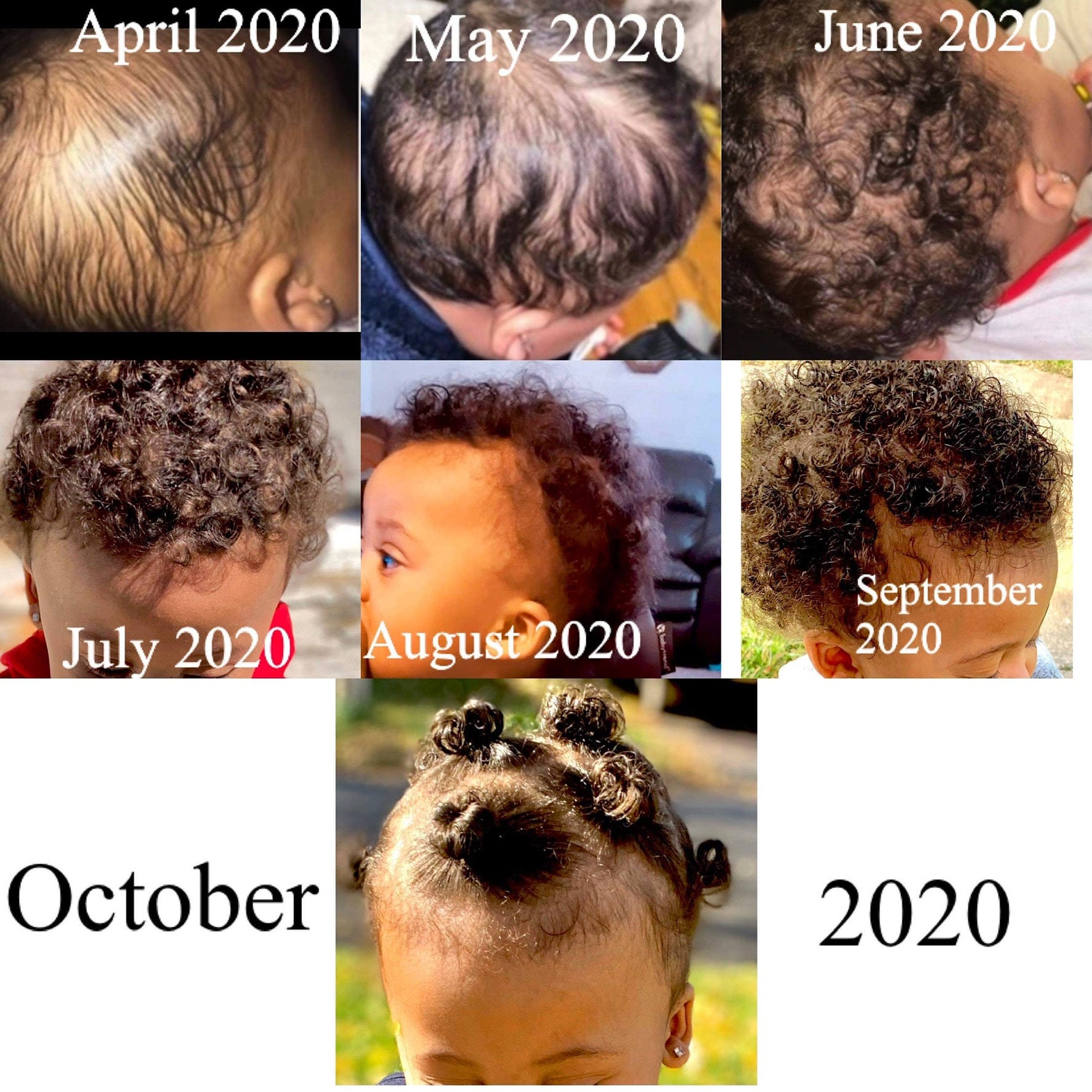 Baby Hair Care Bundle for Cradle Cap Hair Loss Growth and Etsy