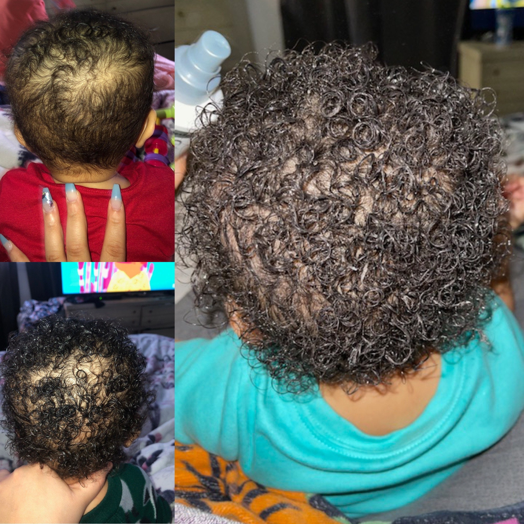 Baby Natural Hair Oil for Growth Dryness and Cradle Cap - Etsy Ireland Baby Natural Hair Oil for Growth Dryness and Cradle Cap - Etsy Ireland