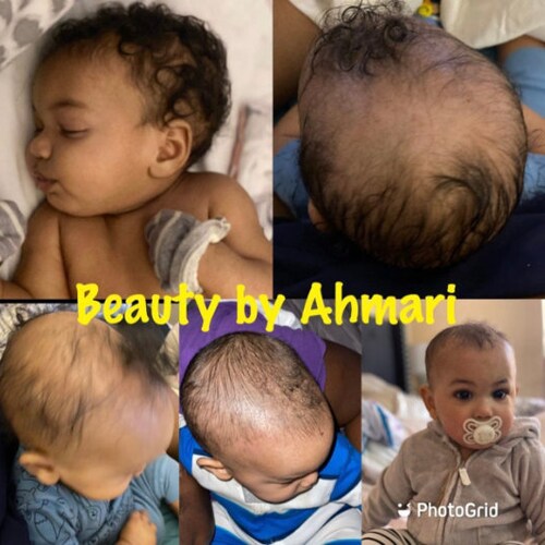 Individual 2 Oz Natural Homemade Baby Hair Oil for Dry Scalp Etsy