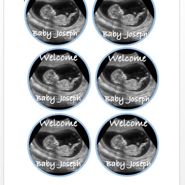 Edible Photo Baby shower cookies treats Real Ultrasound, foto comestible para Galletas, Rice crispy