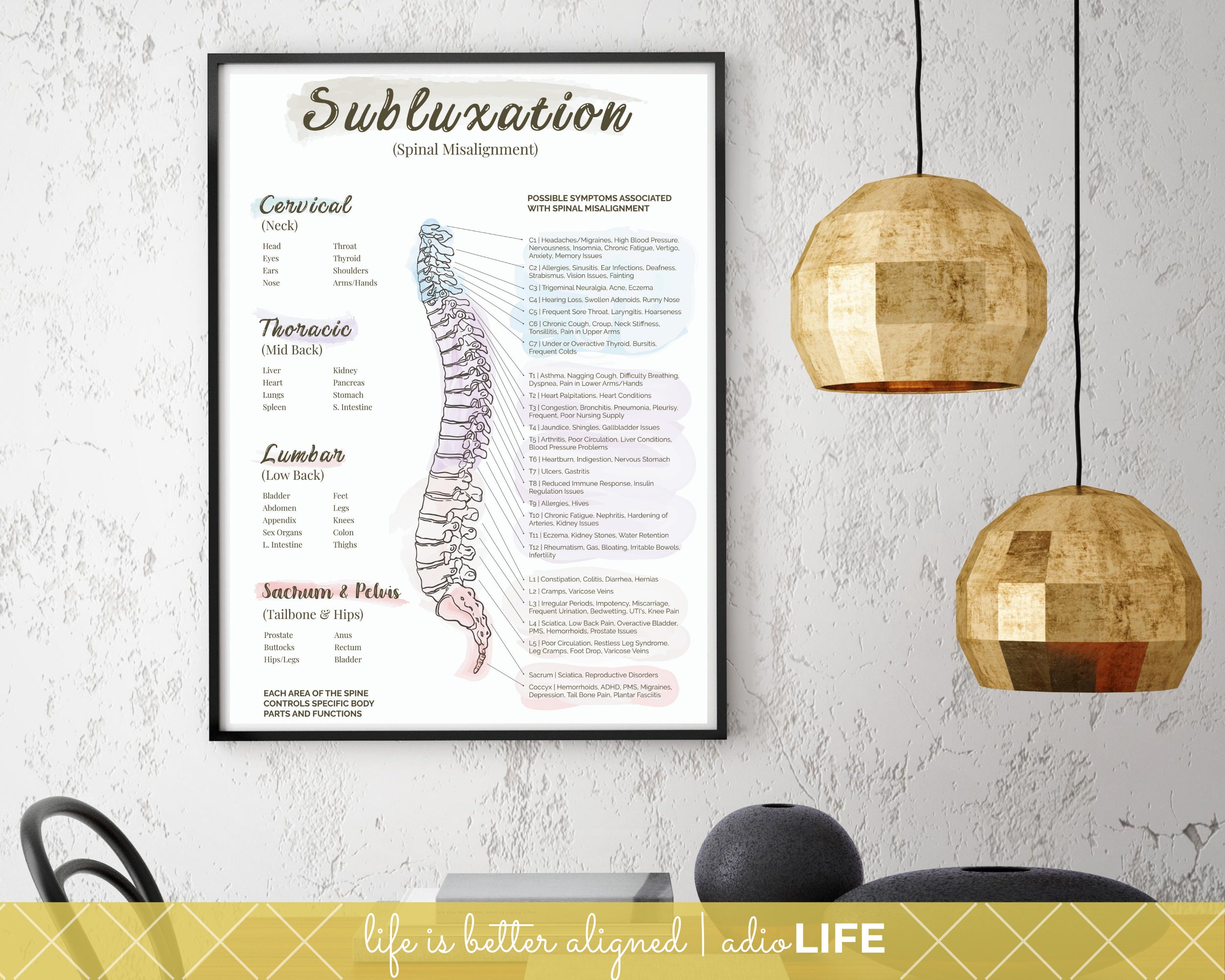 New Subluxation Chart Spinal Nerve Poster Chiropractor Etsy
