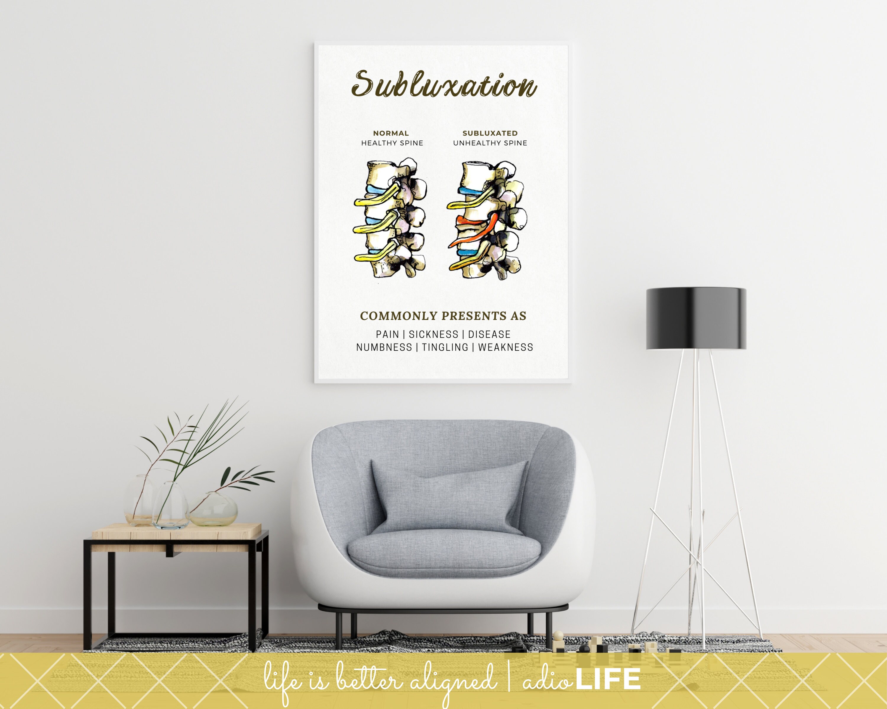 Subluxation Chart, Chiropractic Office Poster, Spinal Nerve Pressure, Chiropractor Education, Graduation Gift, Spinal Misalignment, Brown