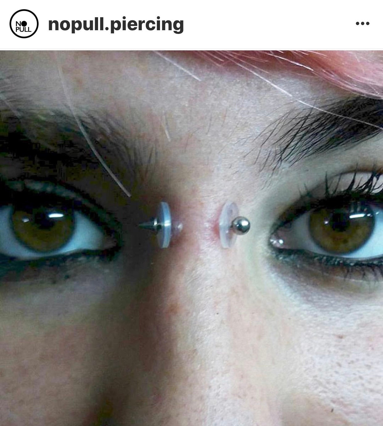 Granuloma En El Piercing Del Ombligo 6 reutilizables NoPull Piercing Disc® Tamaño 7mm 14g - Etsy México