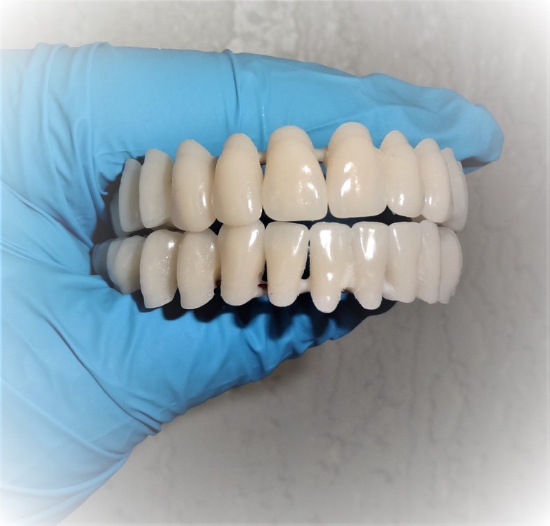 Full Upper and Full lower Placed Acrylic Denture Teeth dental Etsy
