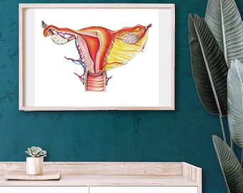Lámina con dibujo de útero - BioCreativeArts - Láminas artísticas para médicos, enfermeras, profesionales de la salud y obstetras-ginecólogos.