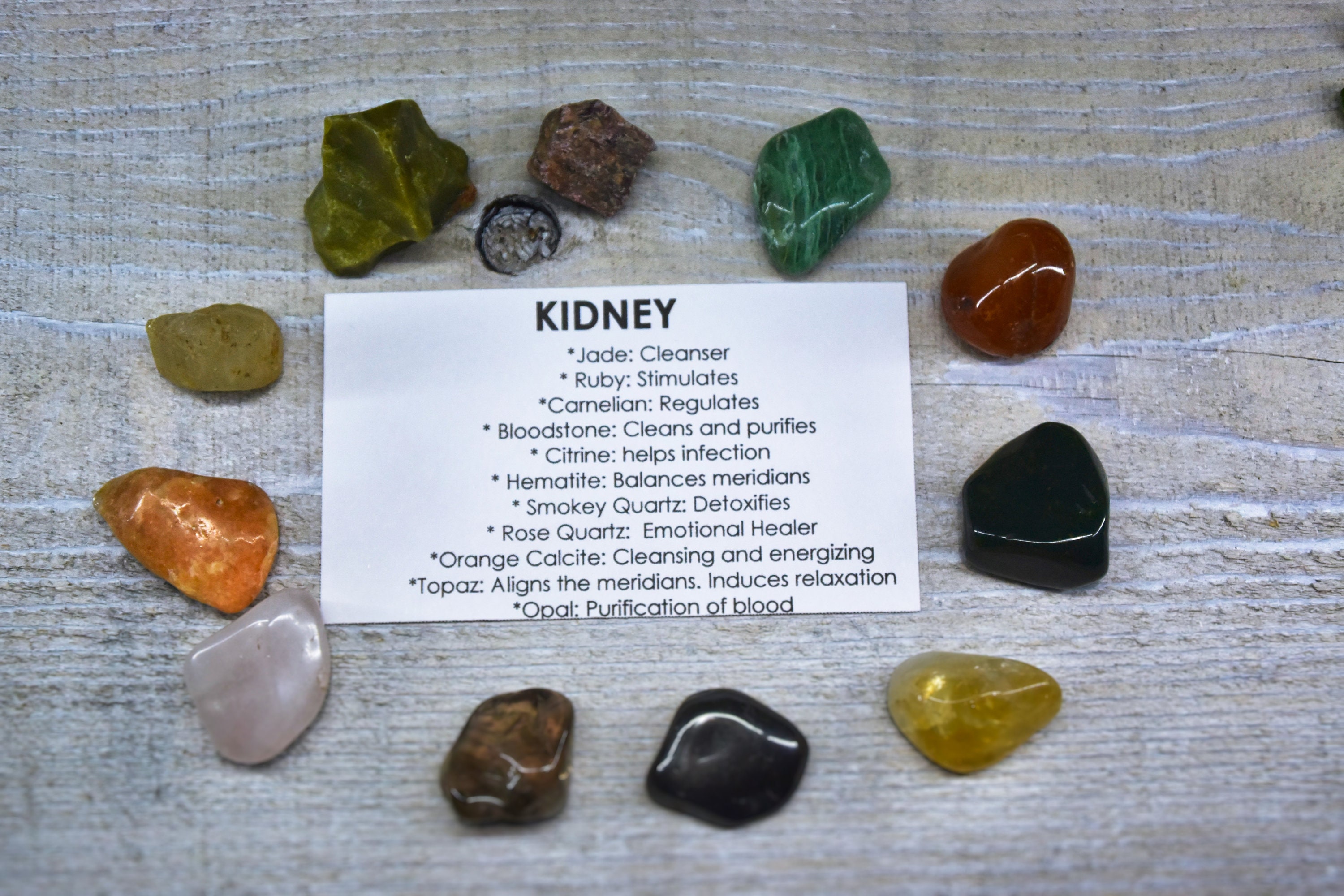 Kidney Crystals Gemstones Kit Kidney Stones Set Kidney Rocks Etsy Canada