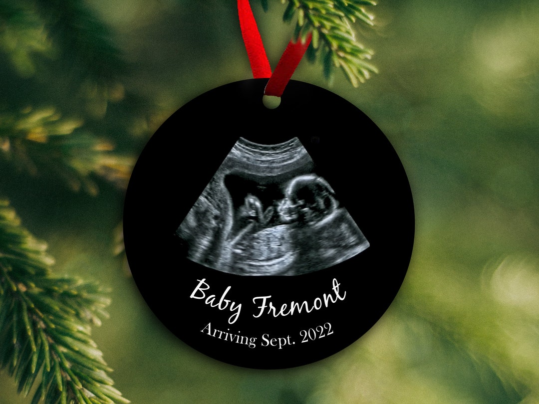 Ultrasound Ornament Frame Pearhead Special Delivery Sonogram