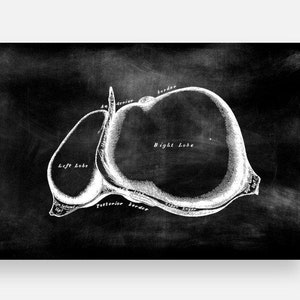 Puede incluir: Una ilustración anatómica en blanco y negro del hígado sobre un fondo de pizarra. La imagen muestra los lóbulos izquierdo y derecho del hígado, así como los bordes anterior y posterior.