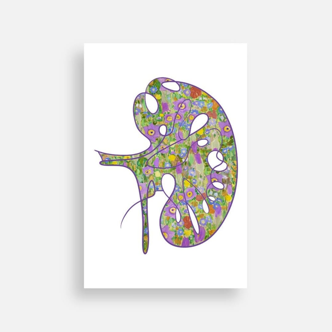 Klimt's kiss Kidney Collection Etsy