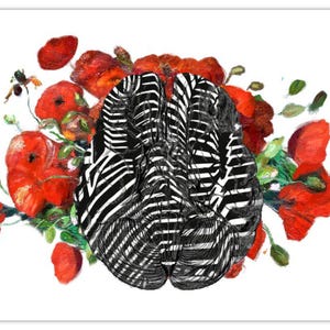 Coquelicot Brain Collection