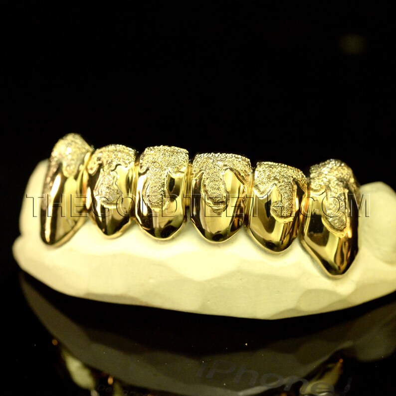 Gold Grillz 10k Gold Teeth Diamond Dust Yellow Gold Grillz Etsy
