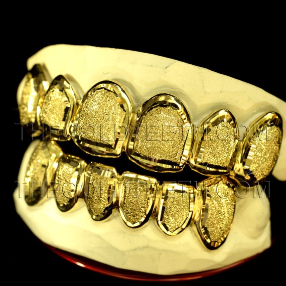 Custom Grillz 10k,14k,18k Gold Teeth Diamond Dust Yellow Grillz