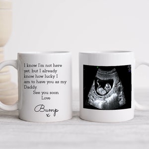 BABY SCAN PHOTO Mug (Personalised Love Bump | Dad to Be Gift | New Dad | New Mum | Mum to be Gift | Nan Grandad | Baby Announcement)