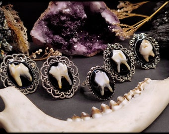 Vintage Zahn Ringe in 2 Farben // Naturschmuck, Knochenschmuck, Knochenring, Hexenring, Hexenschmuck, Gothic Ring, Taxidermy, Knochen, Zähne