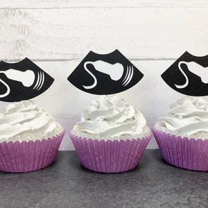 Ultrasound Sonographer Sonography Graduation Graduate School X-ray Radiology Technician Tech Nurse Cupcake Toppers 12 count