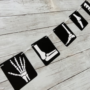 X-ray Radiology Radiography Tech Ultrasound Technician Graduation Rad Grad Doctor Nurse Skeleton Bone Banner Garland Party Decorations
