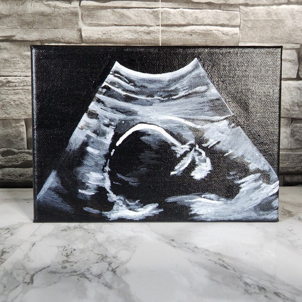Ultrasound Canvas Etsy