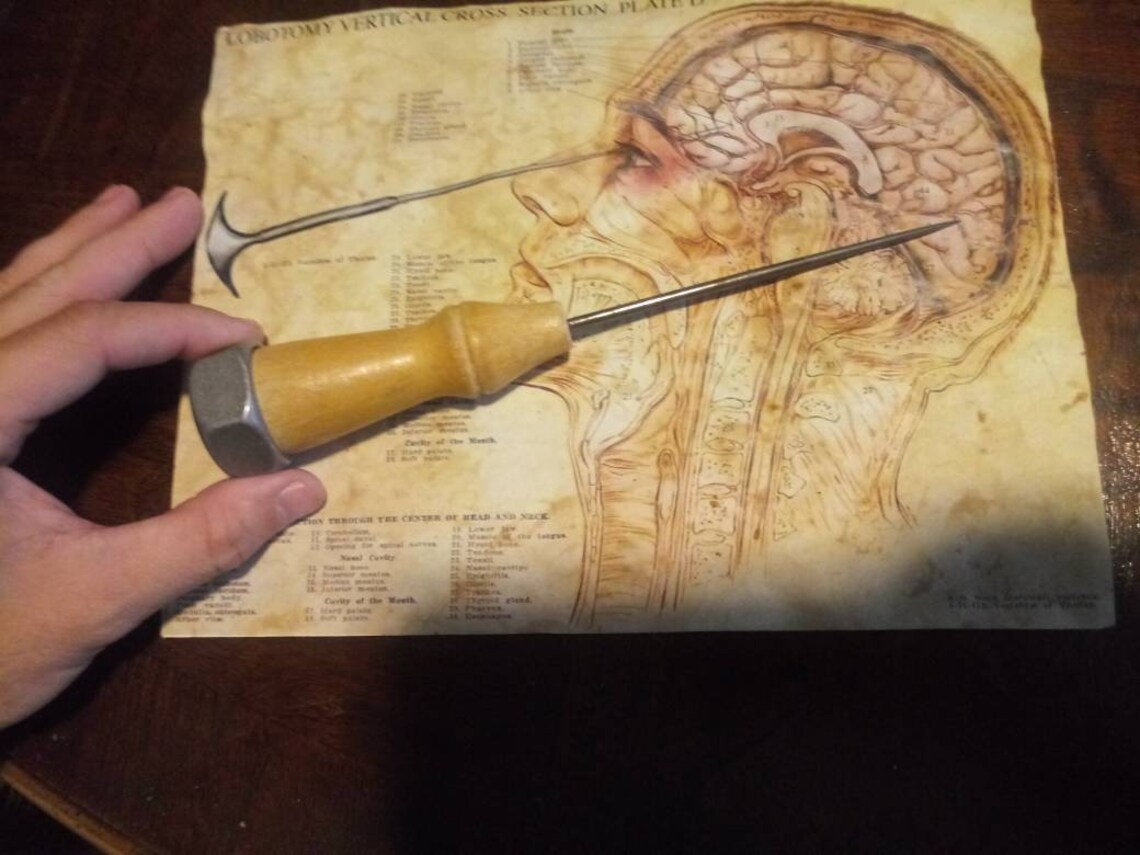 Lobotomy chart with vintage ice pick prop for decorative use Etsy