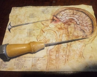 Lobotomy chart replica digital print on standard weight tea aged paper 8.5x11 Ice pick not included