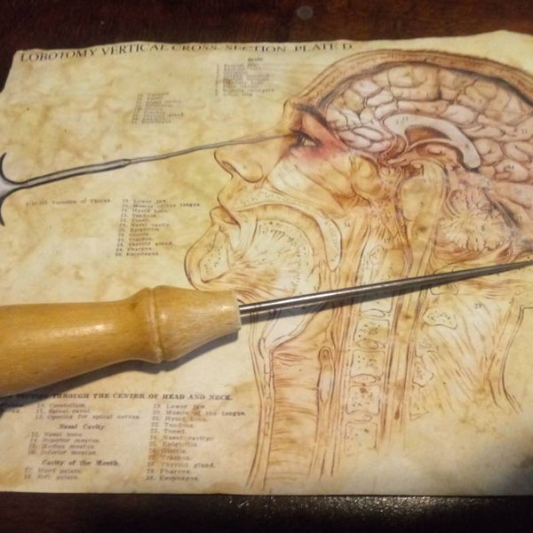 Lobotomy chart replica digital print on standard weight tea aged paper 8.5x11 Ice pick not included
