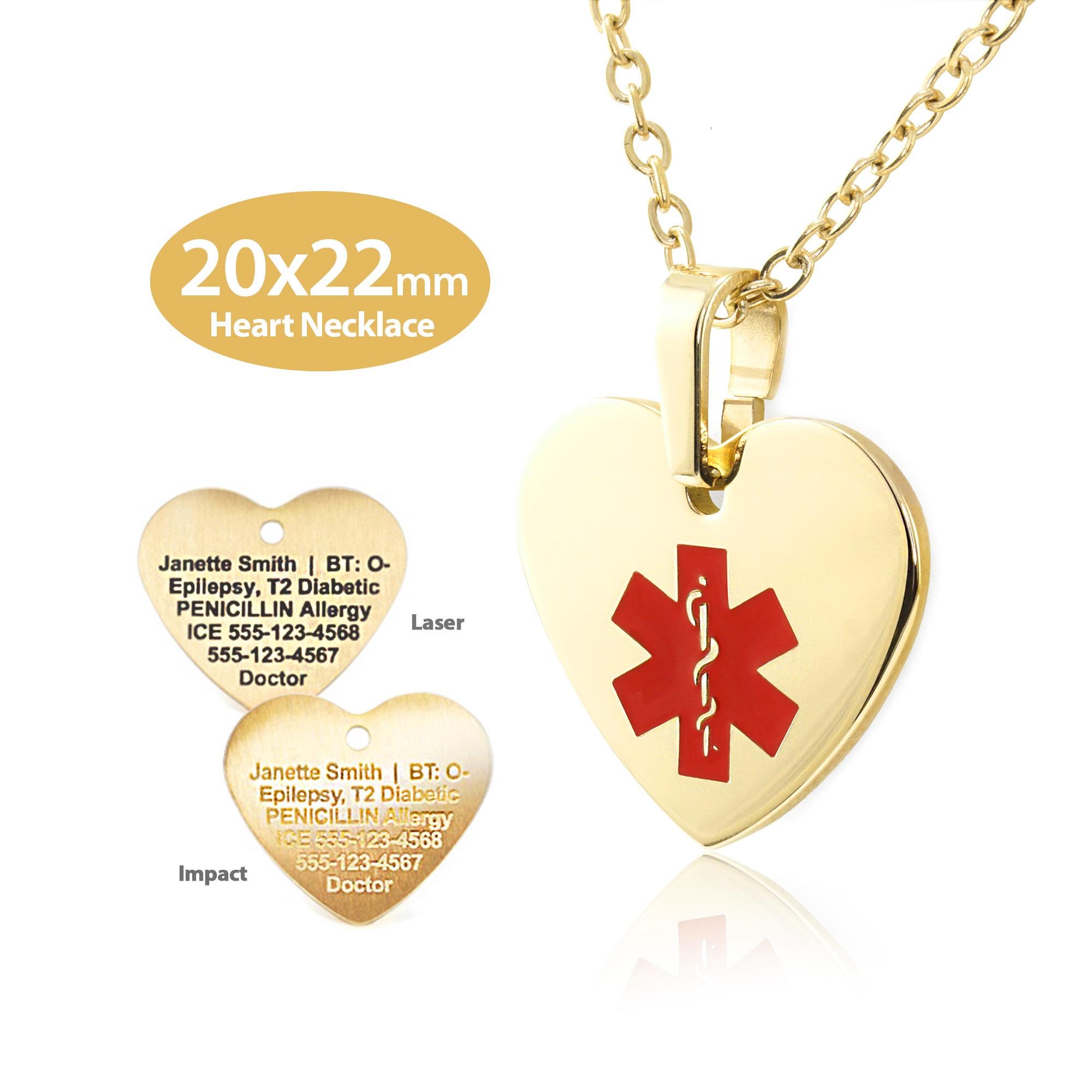 Toggle, Fancy Heart 21x27mm Toggle, Fancy Heart 21x27mm