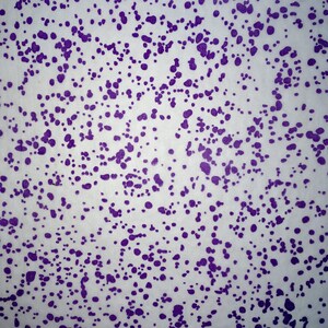 May include: A white background with a scattered pattern of small, purple dots.