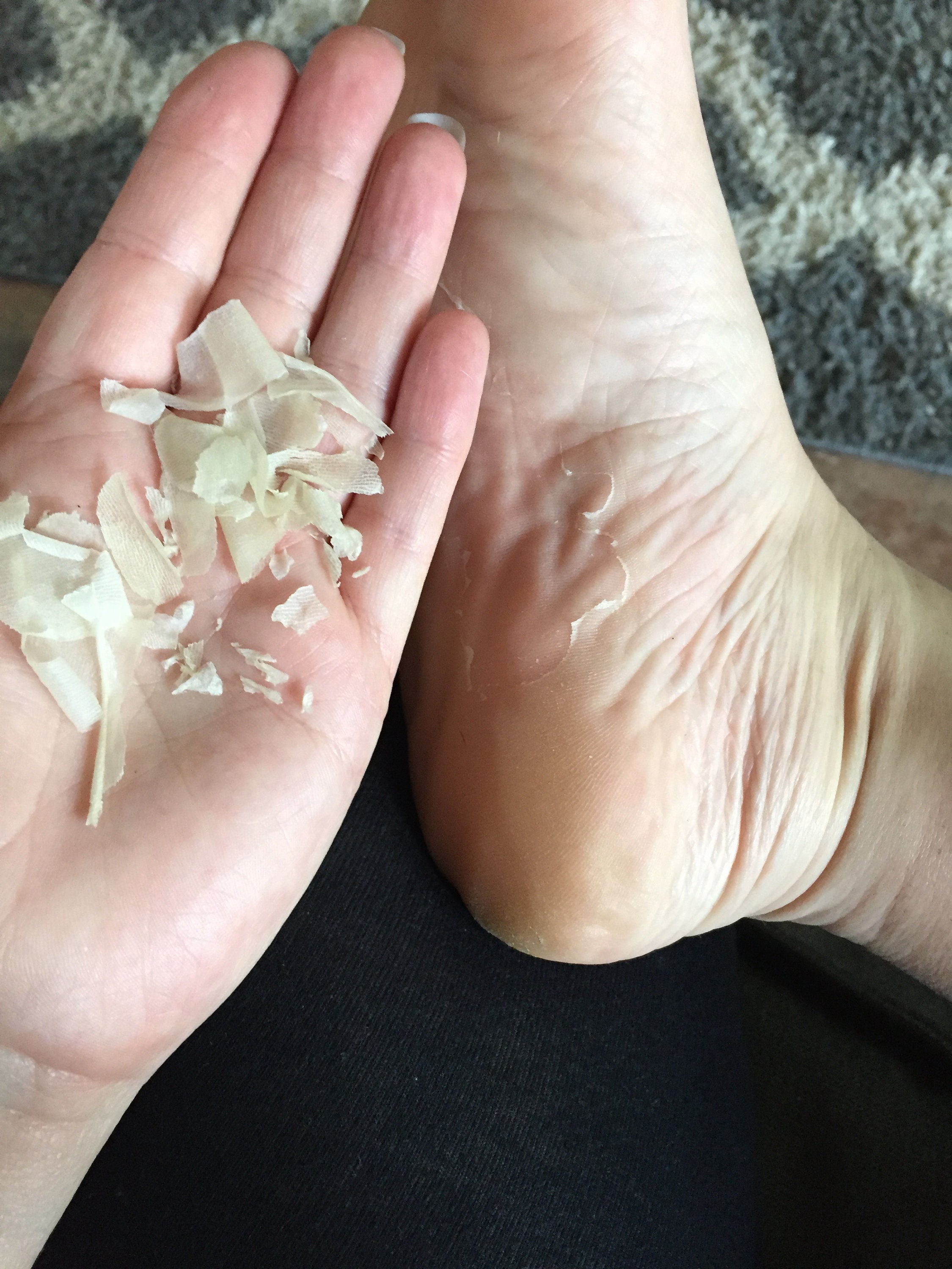 Foot Mask Foot Peel Mask Chemical Foot Peel Foot Peeling Etsy