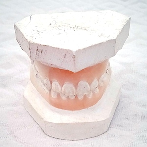 DENTURE - TEETH - dental technician dental plaster cast from the 80s