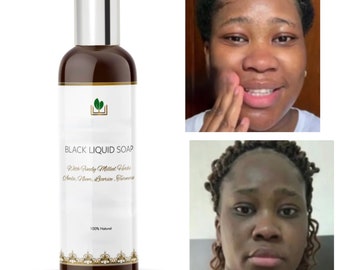 Savon noir liquide, savon noir africain, nettoyant à base de plantes, exfoliant, teint uniforme, peau impeccable