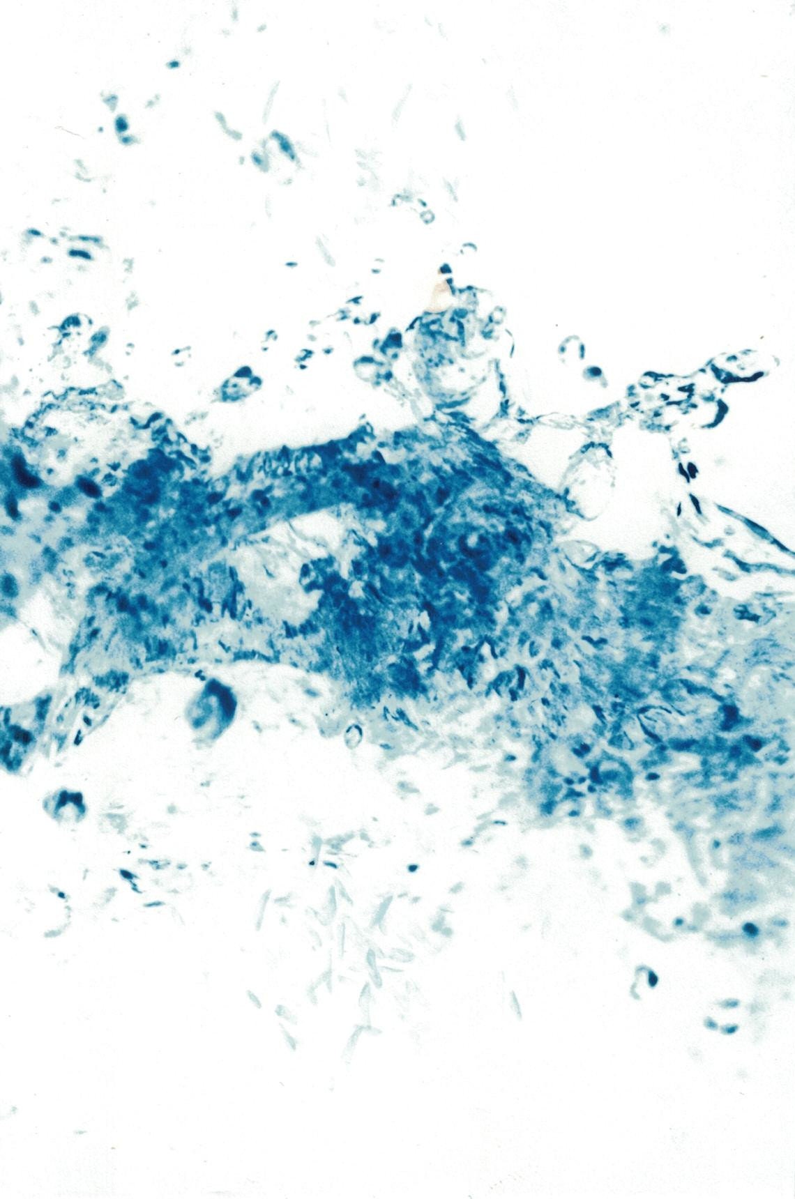 Tableau Photo Analogique Virage Bleu Encadré Fait Main Décoration Murale Originale Unique Art Abstra