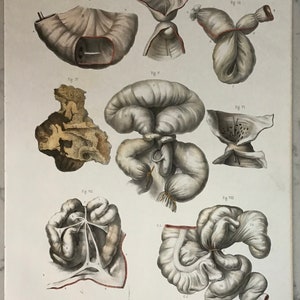 Nicolas Henri Jacob Medical Drawings Lithograph