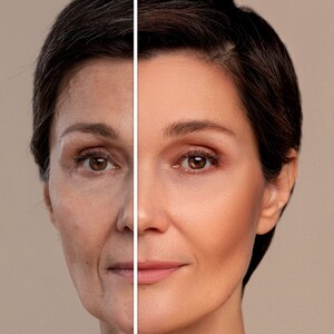 Peut inclure: Comparaison c&ocirc;te &agrave; c&ocirc;te du visage d'une femme, montrant la diff&eacute;rence entre sa peau naturelle et sa peau apr&egrave;s un traitement cosm&eacute;tique. Le c&ocirc;t&eacute; gauche de son visage montre des rides et des lignes, tandis que le c&ocirc;t&eacute; droit appara&icirc;t plus lisse et plus jeune.