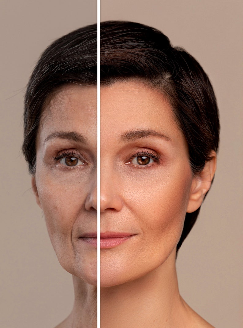 Peut inclure: Comparaison c&ocirc;te &agrave; c&ocirc;te du visage d'une femme, montrant la diff&eacute;rence entre sa peau naturelle et sa peau apr&egrave;s un traitement cosm&eacute;tique. Le c&ocirc;t&eacute; gauche de son visage montre des rides et des lignes, tandis que le c&ocirc;t&eacute; droit appara&icirc;t plus lisse et plus jeune.