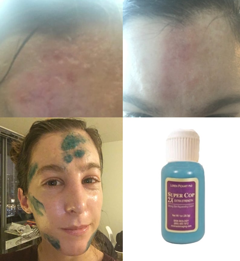 Ghkcu Copper Peptide Serum, Copper Peptide ghkcu Cream for Scar