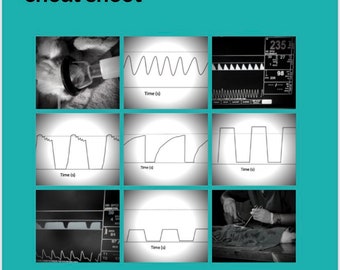 Capnography waveform cheat sheet reference cards