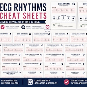 ECG Rhythm Cheat Sheets Bundle | Nursing School EKG Interpretation Study Guide (Digital Download)