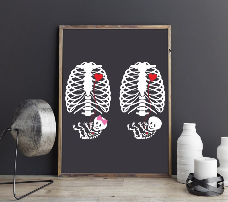 Free Free Baby Skeleton Svg Free 81 SVG PNG EPS DXF File