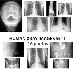 X-Ray Images for Posters Xray Printable, X Ray Digital Download, Bones Clipart, Medical Collage, Gift for Doctor, Doctor Office Decor, Set 1