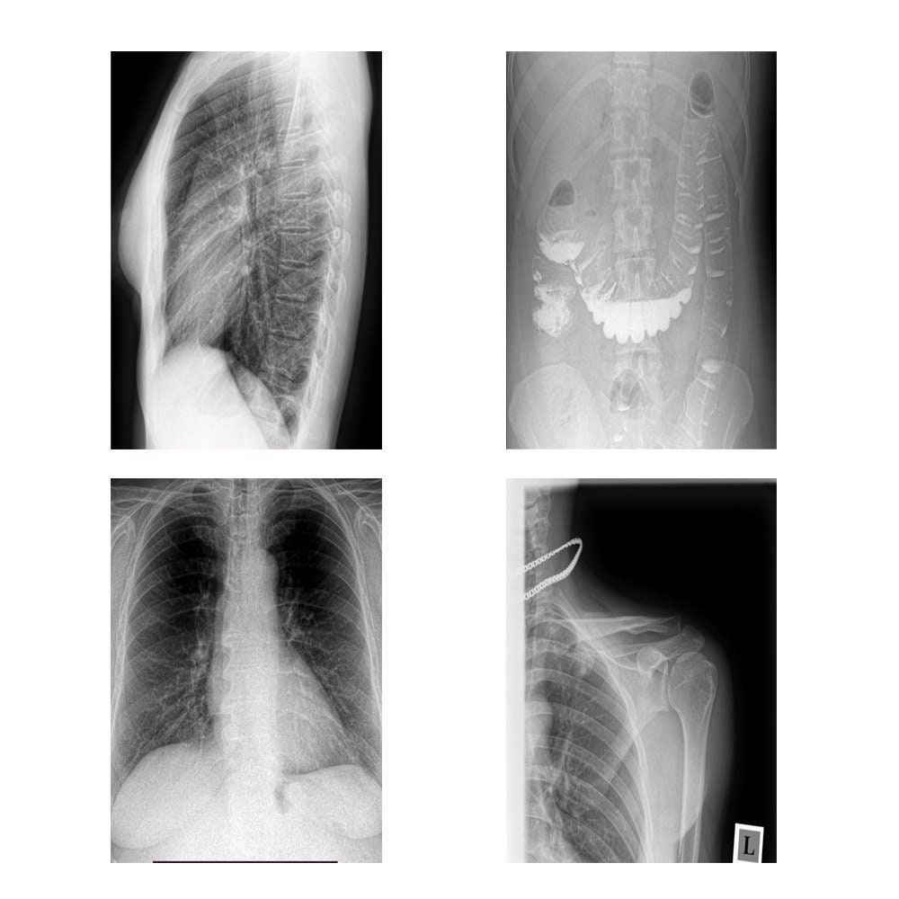 X-ray Images for Posters Xray Printable, X Ray Digital Download, Bones ...